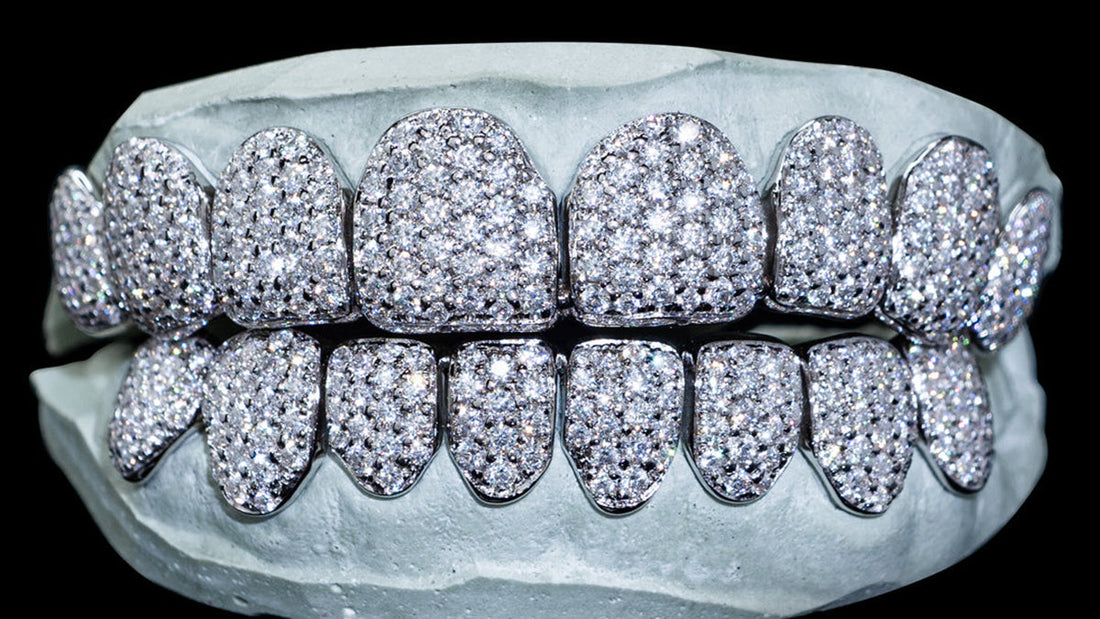 How Much Are Moissanite Grillz?